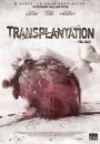 Transplantation