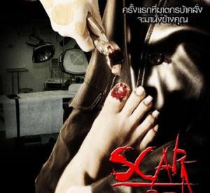 Scar 3D