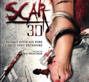 Scar 3D