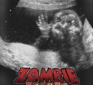 Zombie Babies