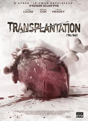 Transplantation