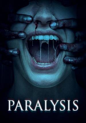 Paralysis