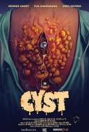 Cyst